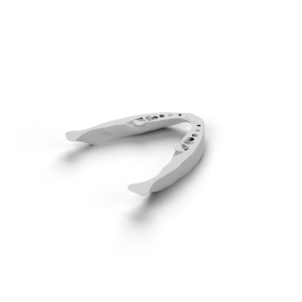 jaw lower view 2