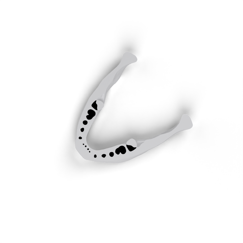 jaw lower view 4
