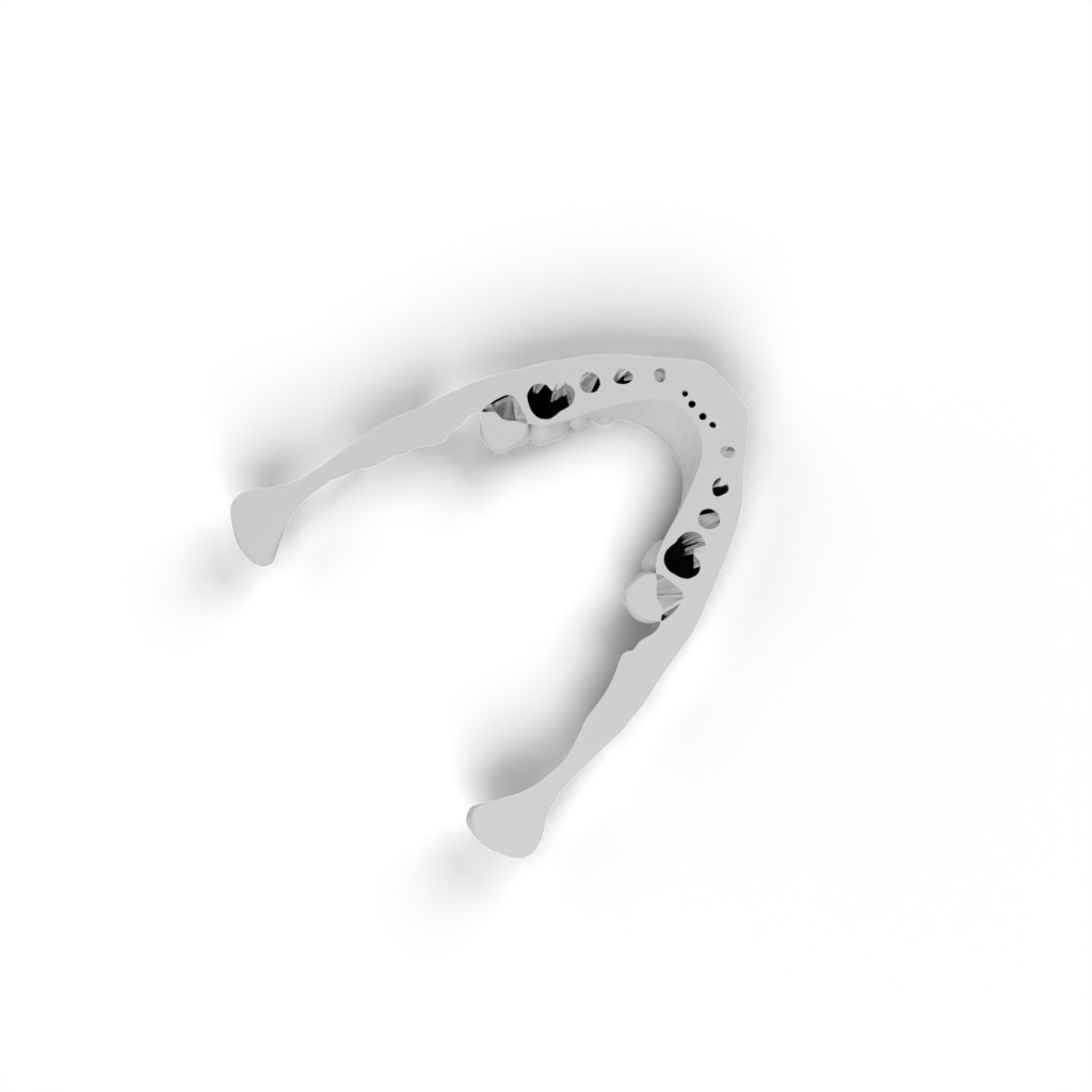 jaw top view 3